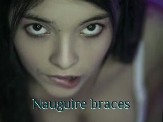 Nauguire_braces